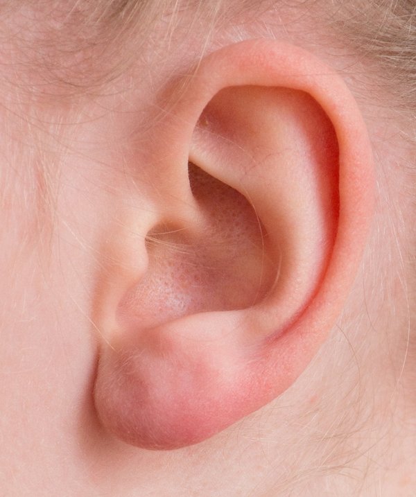 Oreille bouchée : comprendre sans bouchon ni douleur